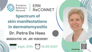 New ERN ReCONNET webinar: Spectrum of skin manifestations in dermatomyositis